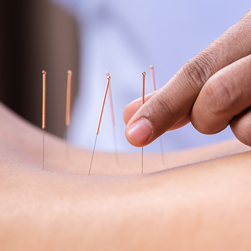 porto massagens terapia